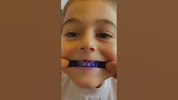خلودة بدو يجرب ينظف سنانو من المسحوق الازرق 