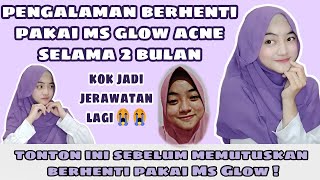 REVIEW SKINCARE MS GLOW ACNE | Pengalaman Jujur Saat Berhenti Pakai Ms Glow Acne