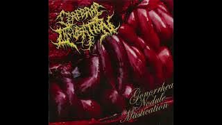 Cerebral Incubation - Gonhorrea Nodule Mastication [Full Album]