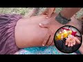 ASMR] BACK CRACKING &amp; MASSAGE •BACK STRETCH WITH NARRATION