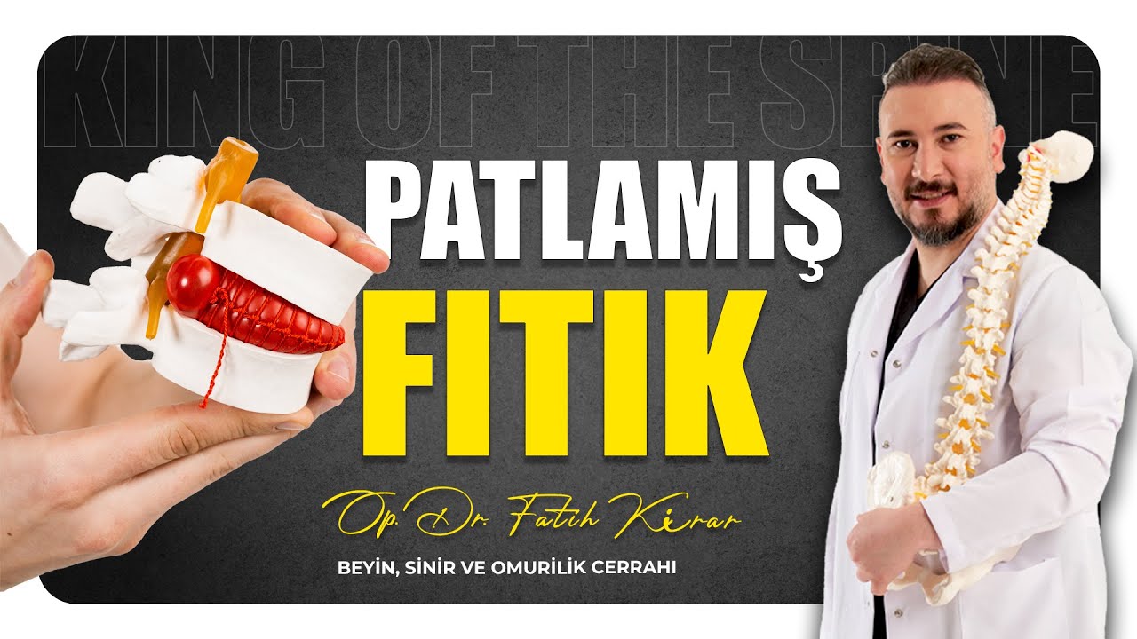 Patlamış Fıtık Nedir? Belirtileri ve Tedavi Yöntemleri! | Op.Dr. FATİH KIRAR