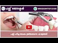 പല്ല് പറിച്ച ശേഷം  ശ്രദ്ധിക്കേണ്ട കാര്യങ്ങൾ/Things to look out for after Tooth Extraction