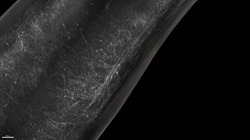 Regeneration across complete spinal cord injuries reverses paralysis