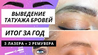 ВЫВЕДЕНИЕ ТАТУАЖА БРОВЕЙ || Лазер + ремувер || Итог за год || Ожидания - реальность