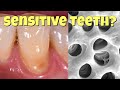 Why teeth get sensitive, and how to fix it
