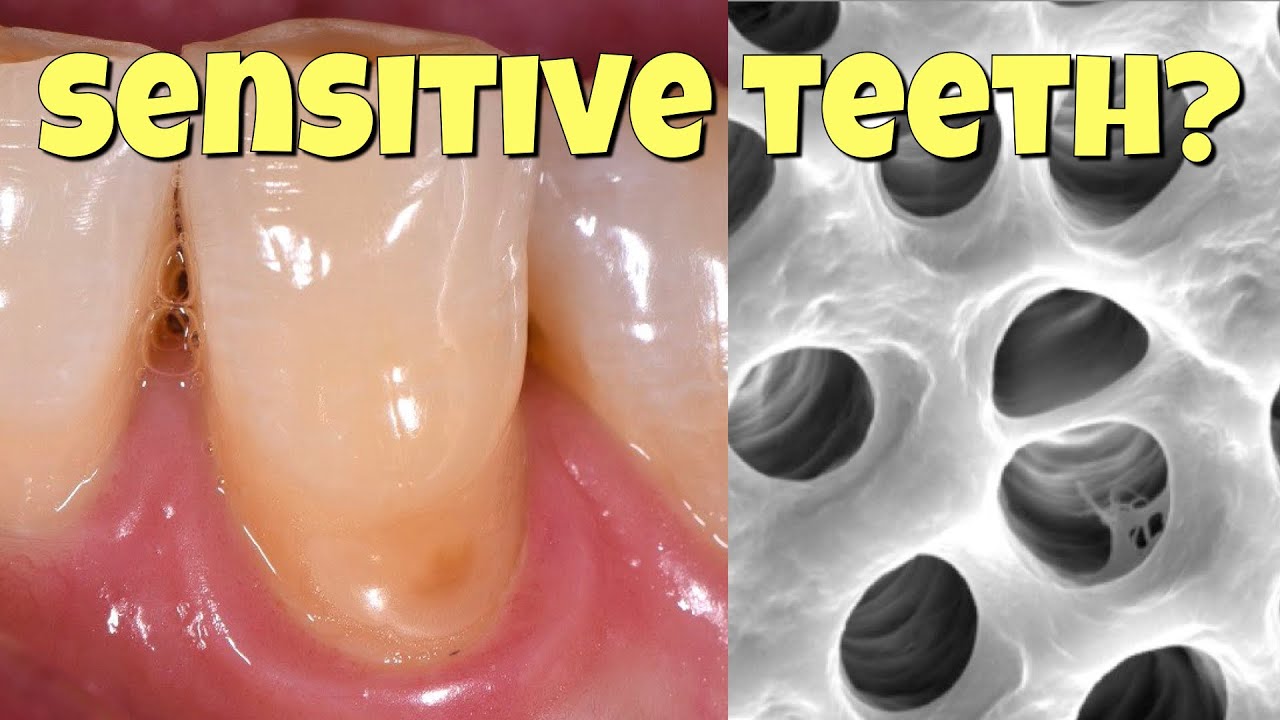 Why teeth get sensitive, and how to fix it