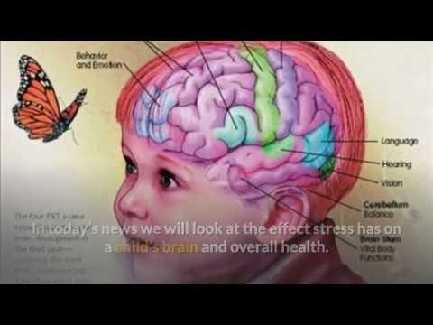 Stress And Your Childs Brain >> A Stressed Out Childhood Could Hurt Your Child S Brain And Overall Stress And Your Childs Brain >> A Stressed Out Childhood Could Hurt Your Child S Brain And Overall