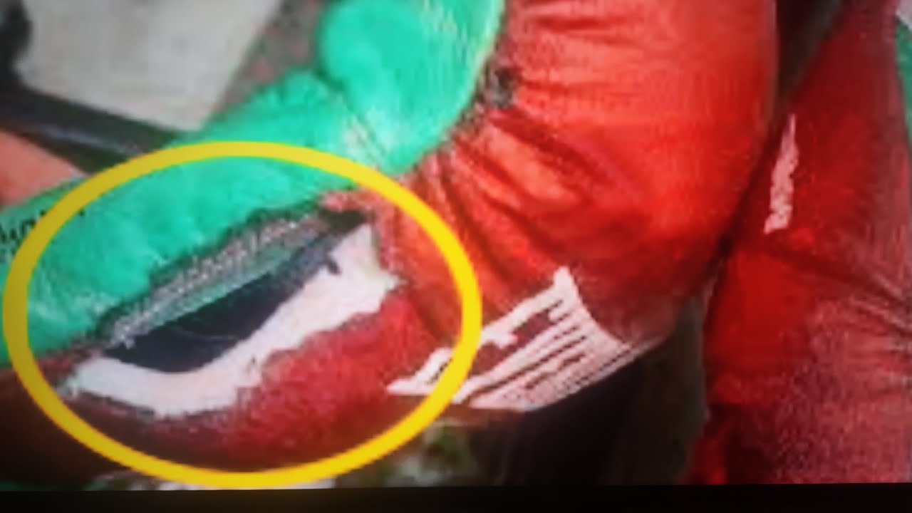 TERENCE CRAWFORD THERAPEUTIC USE EXEMPTION + BUD TAKE LEGAL STEROIDS 