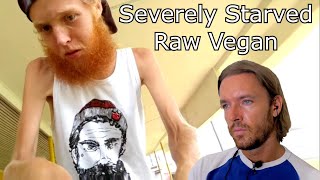 From Extremely Malnourished Vegan to Healthy Organ Eater @Austin.vanderweil