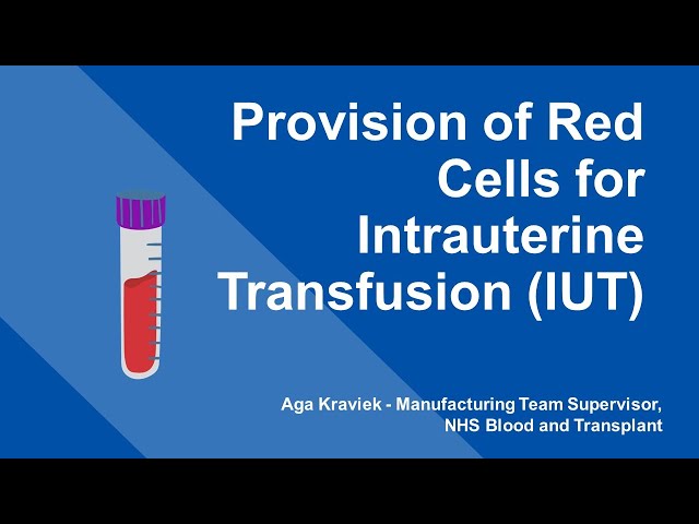 London RTC Education Session - Provision of Red Cells for Intrauterine Transfusion (IUT) class=