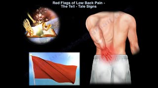 Red Flags of Low Back Pain, When You Start to Worry -Everything You Need To Know -Dr. Nabil Ebraheim