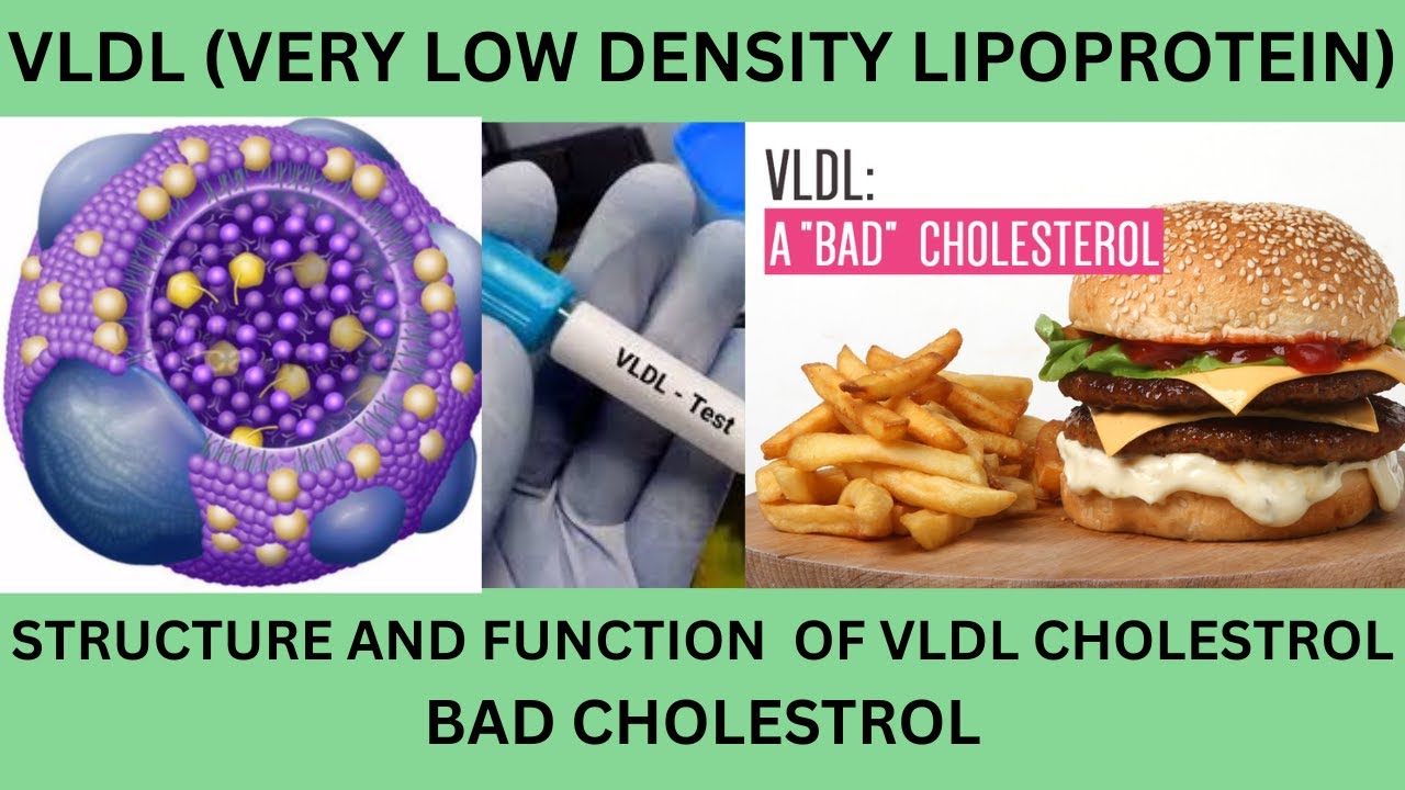 VLDL BLOOD TEST.VLDL STRUCTURE AND FUNCTION.NORMAL RANGES.HIGH VLDL AND COMPLICATIONS