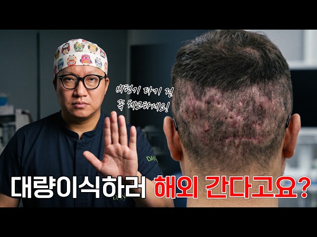 해외 원정 모발이식! 조심스럽게 만류하는 이유