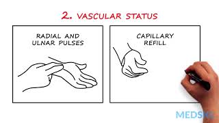 Hand and/or Wrist Injuries: How to easily test nerve function