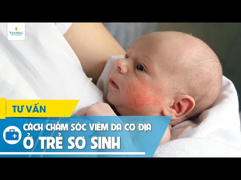 Video: Viêm Da ở Trẻ Sơ Sinh: Nguyên Nhân Và Phương Pháp điều Trị