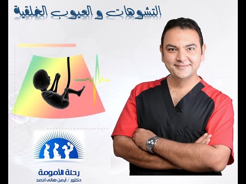 حملى الأول كان مصاب بتشوه هل ممكن يتكرر فى حملى التانى