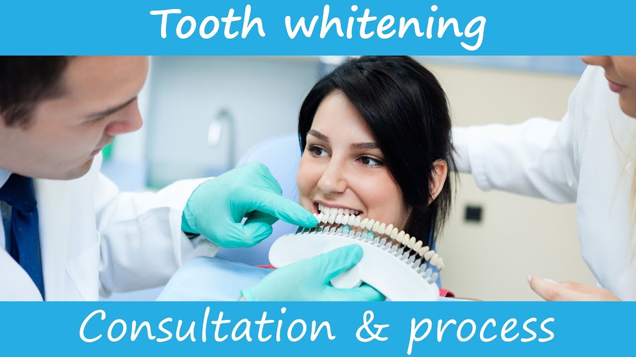 Teeth Whitening At The Dentist - An Example Consultation To Start Professional Teeth Whitening