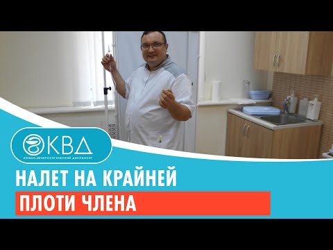 Видео: Smegma: Идентификация, премахване, превенция и др