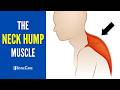 Release THIS Muscle to Fix Your Neck Hump