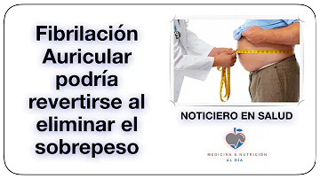 ¿Puede desaparecer la fibrilación auricular con la pérdida de peso?