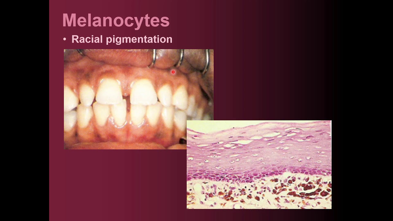 Oral mucosa - Non-keratinocytes, lamina propria & Basal lamina