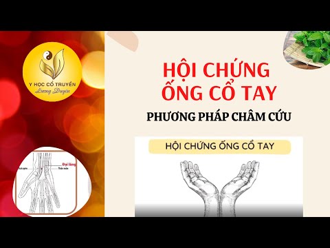 Phương Pháp Châm Cứu Trong Hội Chứng Ống Cổ Tay