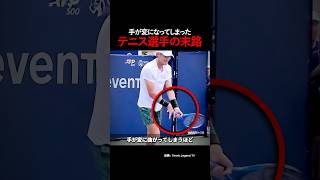 手が変になってしまったテニス選手の末路