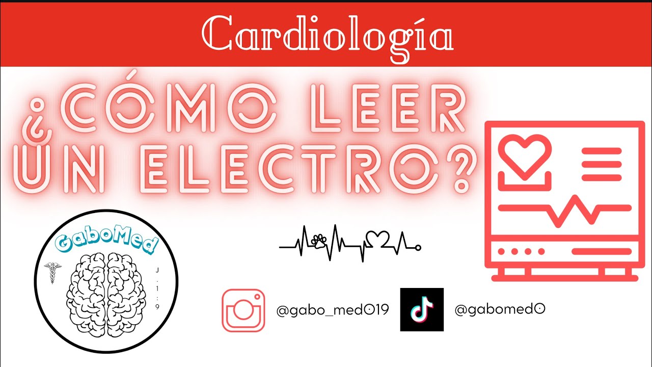 ¿Cómo Leer Un Electrocardiograma? Paso A Paso - YouTube