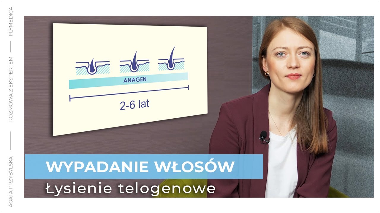 Wypadanie włosów - łysienie telogenowe