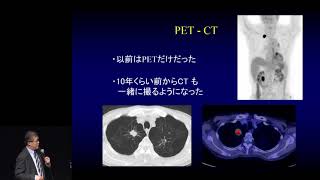 肺がんの診断、特にCTとPET　豊田 尚之