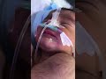 Newborn RDS baby || cute baby observation #nicubaby #nicumom #nicuawareness #nicuwarrior