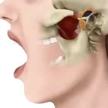 Раскрытие челюсти - YouTube