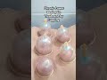 Lower Back pain Treatment by cupping #Hijama Therapy #LBA#कमर दर्द #physio #physiotherapy#