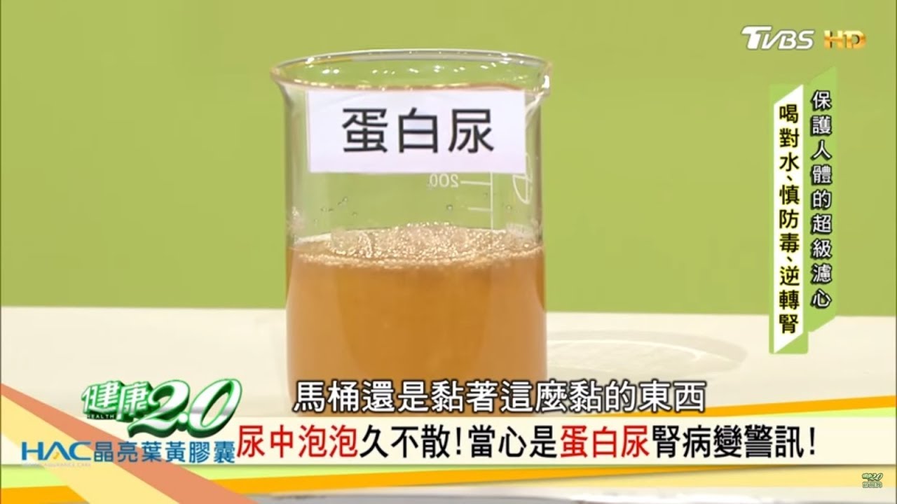 尿中泡泡久不散 當心是 蛋白尿 腎病變警訊 健康2 0 Youtube