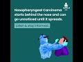 "Nasopharyngeal carcinoma is rare but can be life-threatening if missed early