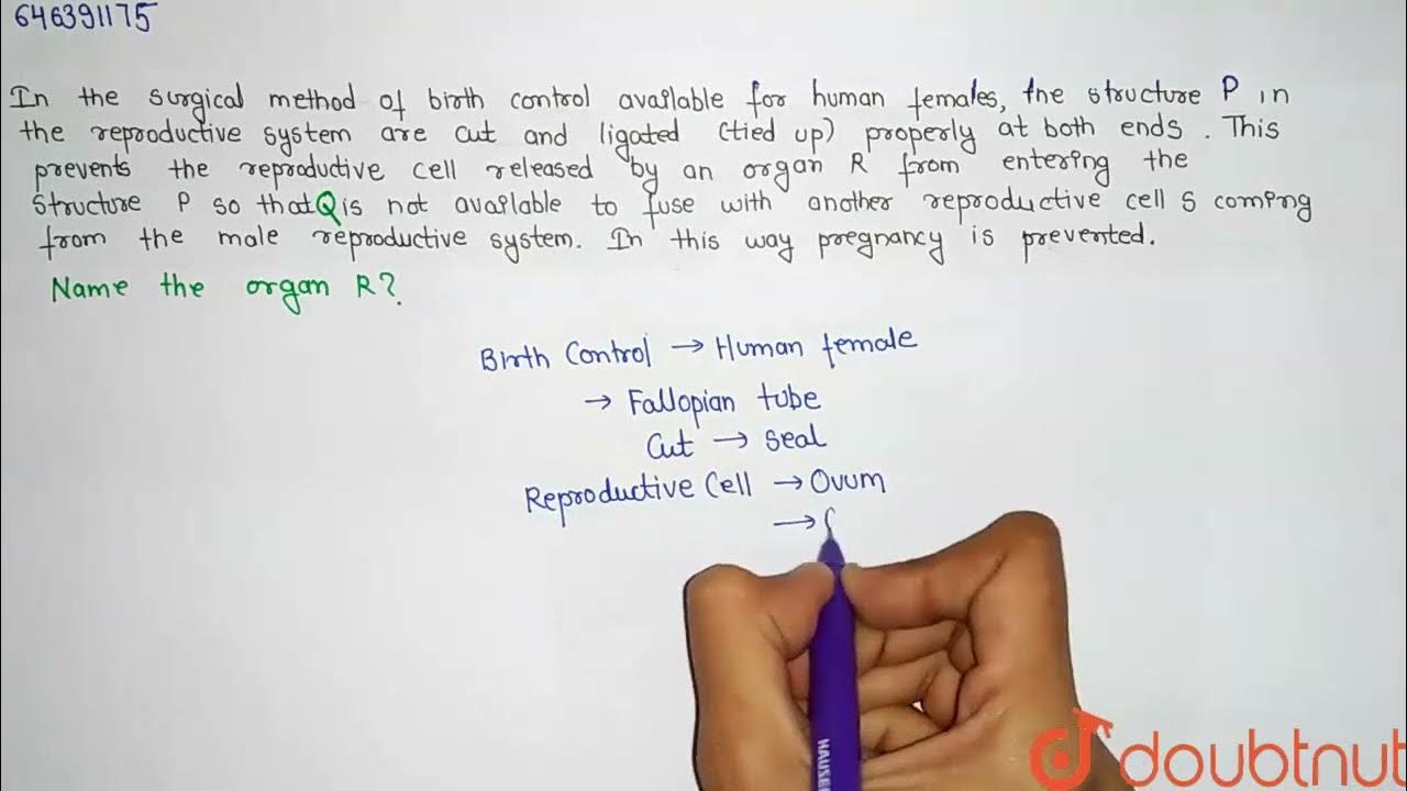 In The Surgical Method Of Birth Control Available For Human Females in-the-surgical-method-of-birth-control-available-for-human-females