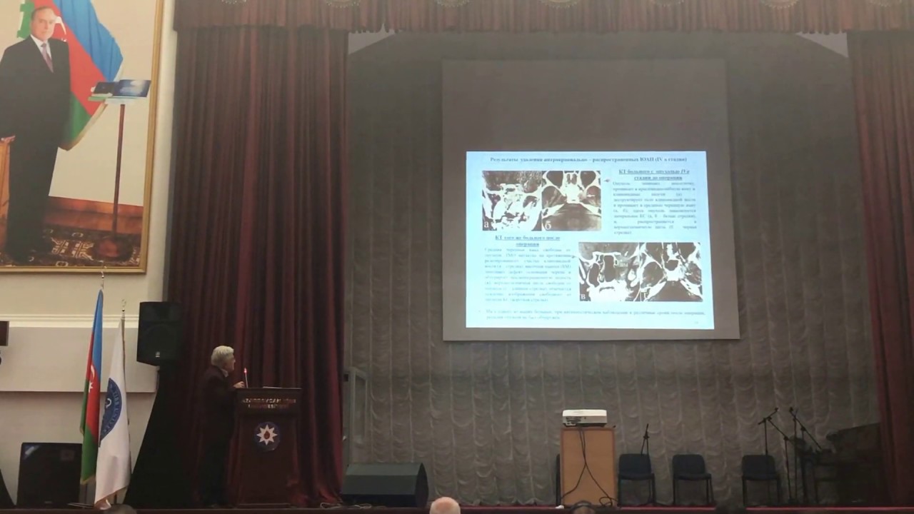 Rzayev R.M. Ангиофиброма носоглотки: эндоскопический и микрохирургический методы лечения