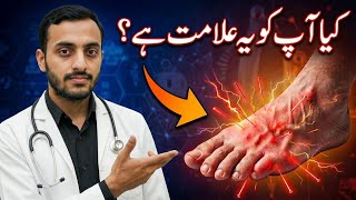 Paon Ki Jalan Khamoshi Se Paon Khatam Kar Deti Hai? | Diabetic Neuropathy |DR YASIR 