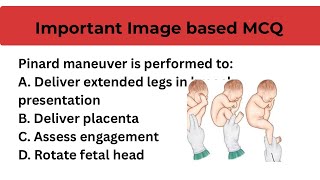 Image-Based Midwifery Maneuver MCQs | Obstetrics Nursing Questions | B.Sc Nursing &amp; Staff Nurse Exam