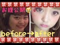【お腹公開w】ちゃっかり２０kg減量した私のダイエット詳細【ベジライフ酵素液紹介】