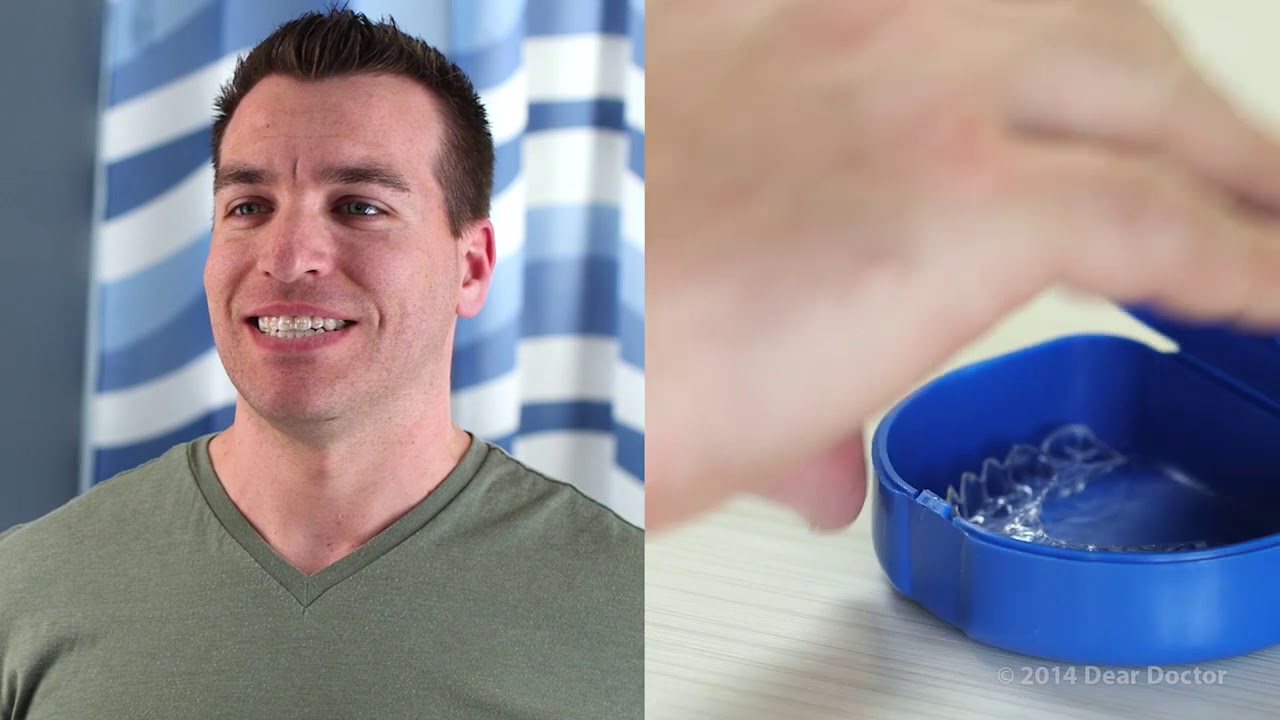How to Clean Clear Aligners - YouTube