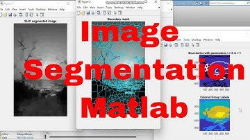 Image Segmentation Matlab / Segmentation with Superpixels SLIC algorithm