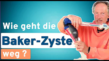 Ist Bewegung bei Bakerzyste gut?