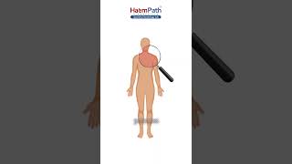 When & Why You Need Blood Disorder Tests | Doctor Explains 🩸| HaemPath Diagnostics
