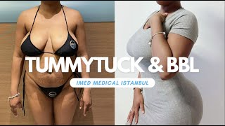 Tummytuck & Bbl By Imed Medical Istanbul