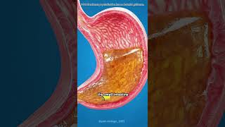 Capsule endoscopy #motivation #doctor #3danimation #science