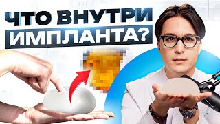 Стоит Ли Бояться Имплантов? Открываем Правду!