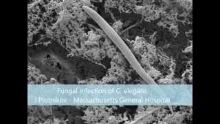 CryoSEM with JEOL Field Emission Scanning Electron Microscope and Quorum CryoSEM