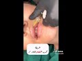 طريقة سهلة وحلوة للمبتدئات لتحديد تاج الشفة بشكل جميل وبارز لايفوتكم حبايب طريقة سهلة وحلوة للمبتدئات لتحديد تاج الشفة بشكل جميل وبارز لايفوتكم حبايب