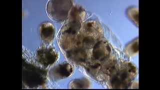 CILIADOS PRORODON COMEN ROTIFERO